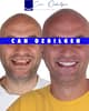 Slider image (9) Can Ozbilgen Advanced & Aesthetic Dentistry